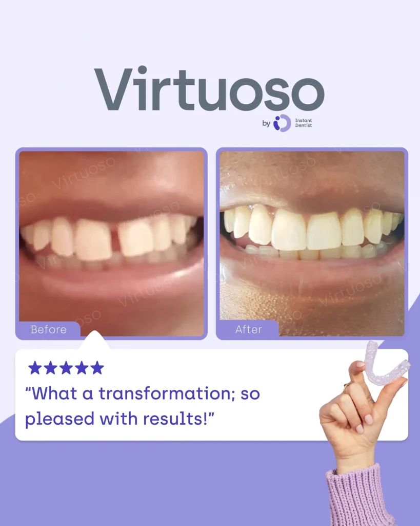 Virtuoso dental results highlighting a satisfied customer's smile transformation.