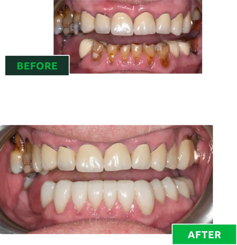 teeth makeover